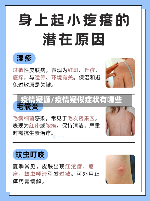 疫情疑源/疫情疑似症状有哪些-第2张图片