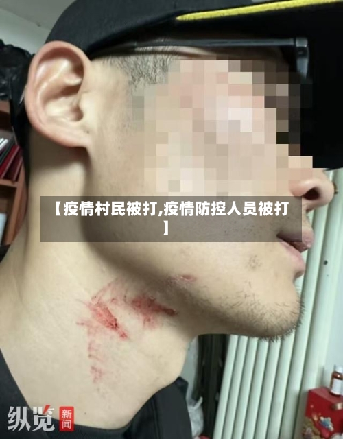 【疫情村民被打,疫情防控人员被打】-第2张图片