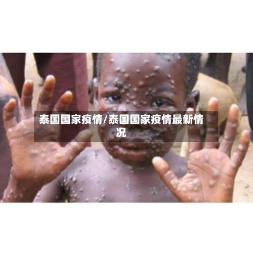 泰国国家疫情/泰国国家疫情最新情况-第1张图片